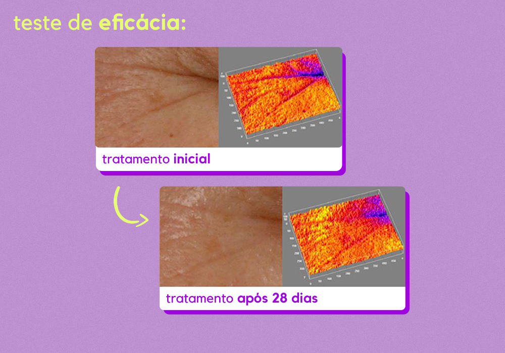 retinol creamy antes e depois