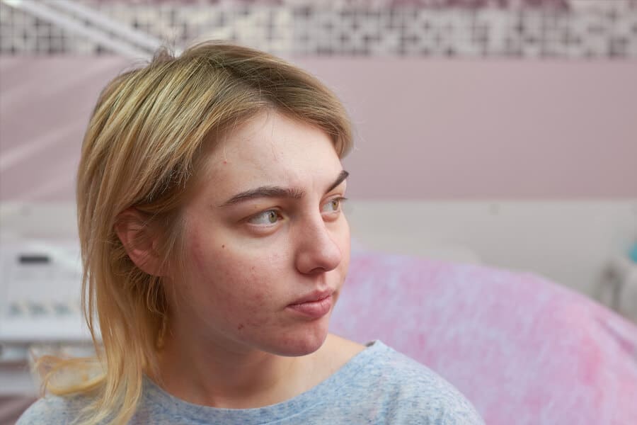 mulher com diferentes tipos de acne no rosto.