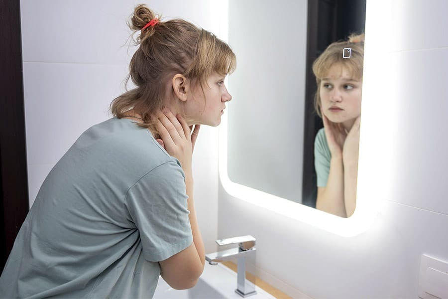 Dermatite seborreica no rosto: confira causas, sintomas e tratamentos