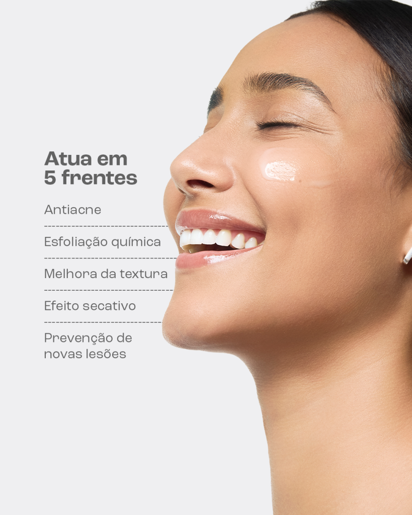 Descubra o que é espinha interna e como tratá-la 4 Mulher sorrindo em um fundo branco.