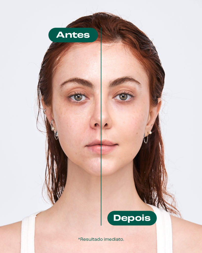 Mulher ruiva e branca, com uma linha dividindo o rosto, com "antes" e "depois", escrito um de cada lado. Do lado esquerdo, o rosto oleoso. Do lado direito, o rosto limpo e seco.